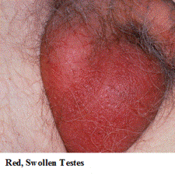 Sore testicles on steroids