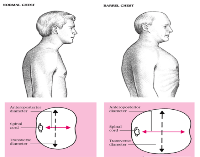 Signs That Show The Lungs Are In The Danger Zone Dr Thind