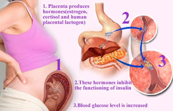 What Are The Symptoms For Diabetes During Pregnancy - Pro-Factory-Plus  Perspective