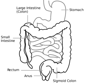 colitis