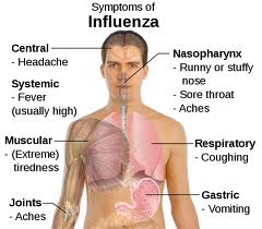 Influenza