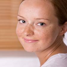 Melasma/ Chloasma/ Pregnancy Mask | Dr. Thind