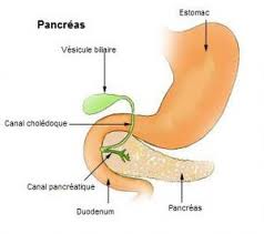 pancreatitis