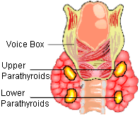 hypoparathyroidism