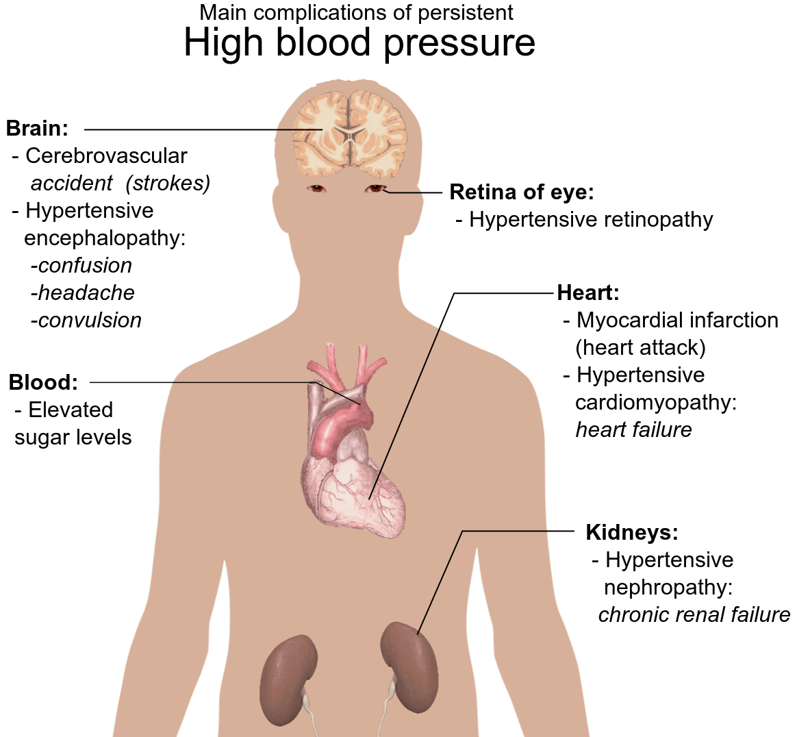 high-blood-pressure-hypertension-dr-thind-s-homoeopathy