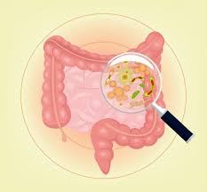 clostridium difficile colitis