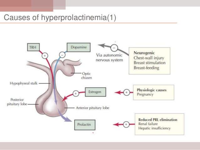 Hyperprolactinemia Causes Symptoms Homeopathic Treatment hyperprolactinemia-causes-symptoms-homeopathic-treatment