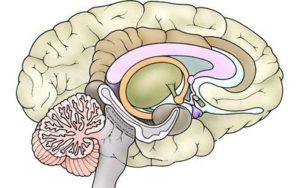 binswanger disease