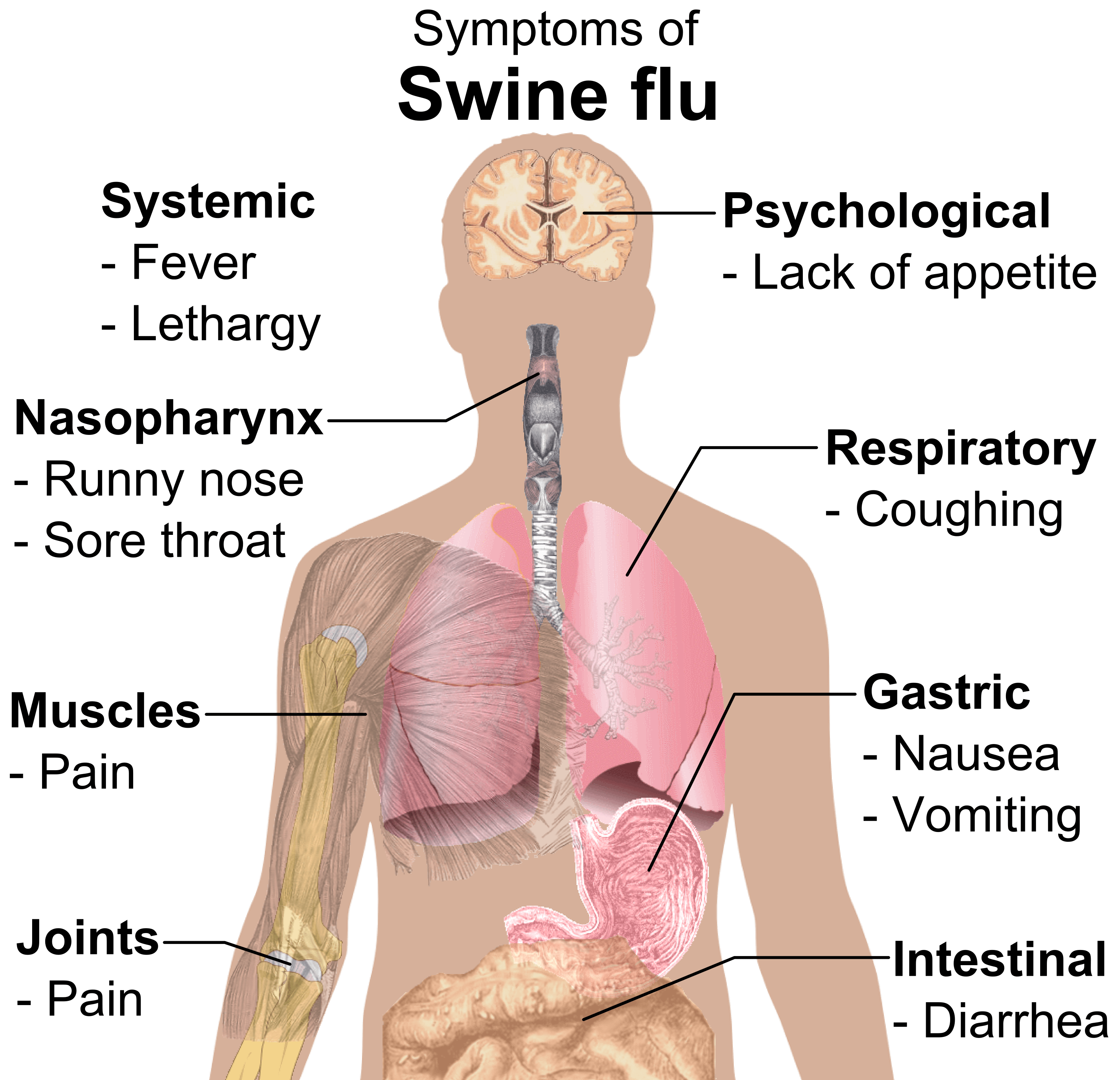 Am I Suffering From Swine Flu? Dr. Thind's Homeopathic Clinic