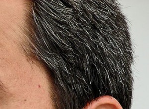 grey hair