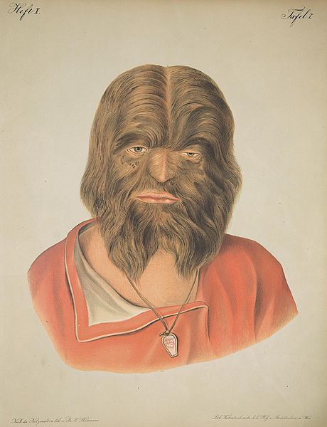 Hairy Faced Man 11