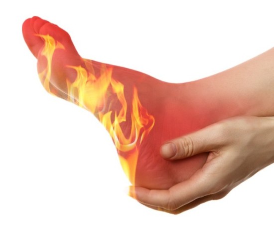 burning foot