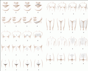 hirsutism