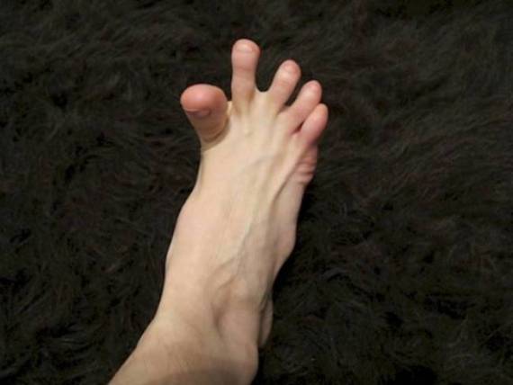 spasm foot