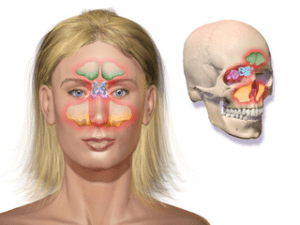 sinusitis treated sinusitis can be cured