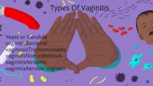 vaginitis prevention