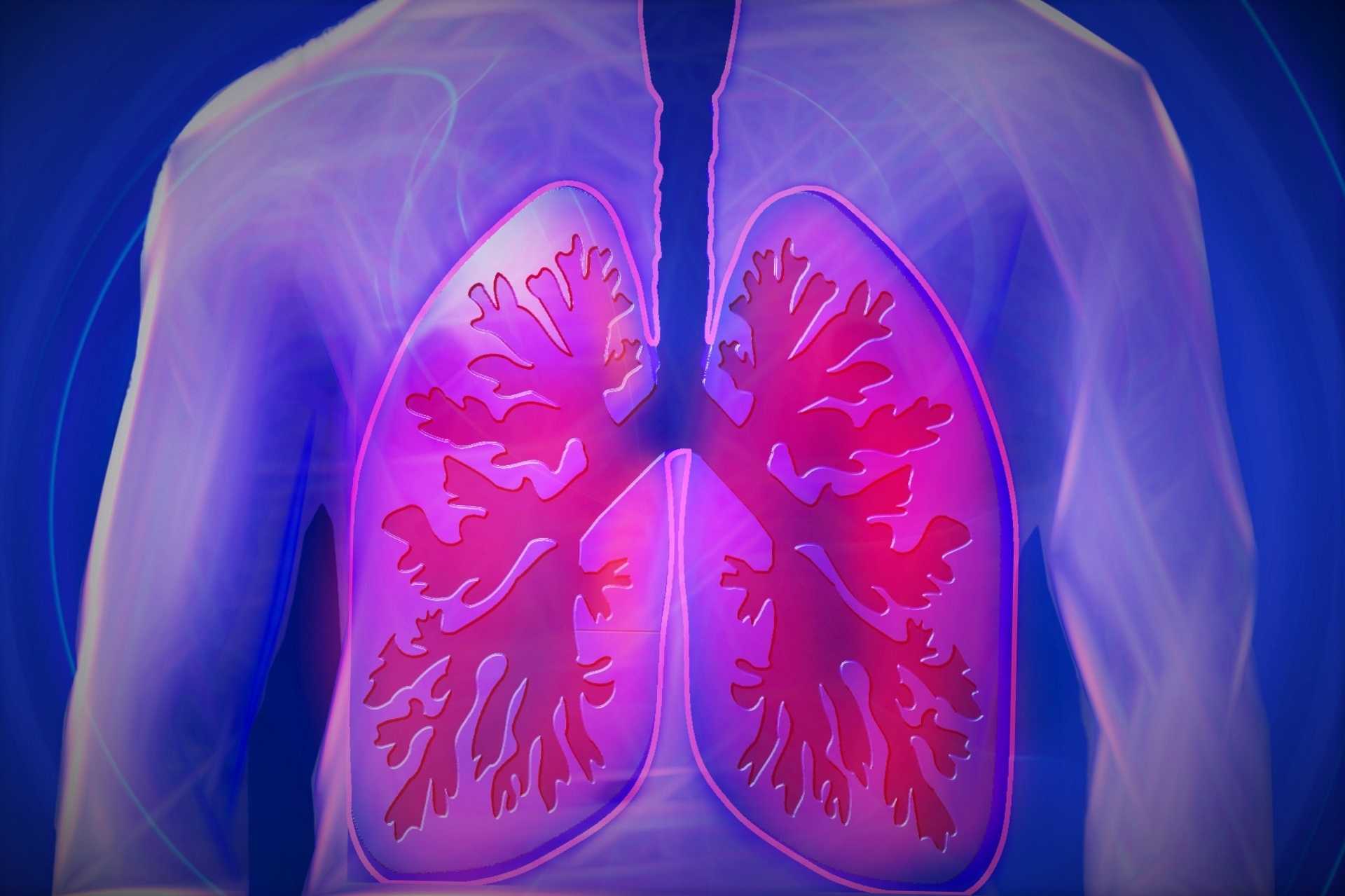 covid and lung diseases